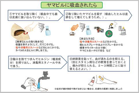 ヤマビルに吸血されない３つの対策と治療の方法